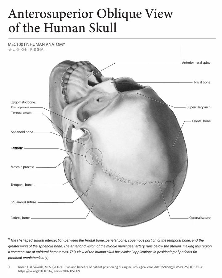 Anatomy Diagram: Anterosuperior View of the Human Skull &amp; Pterion 2D Traditional Illustration made using carbon dust, cold-pressed illustration board, gauche