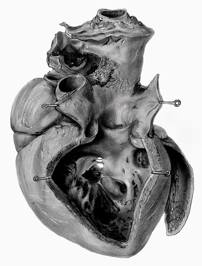 Media Study of Max Brödel’s Dissection of the Human Heart 2D Traditional Illustration made using carbon dust, cold-pressed illustration board, gauche